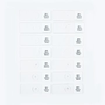 MAYOZ MİTOZ PREPARATLARI