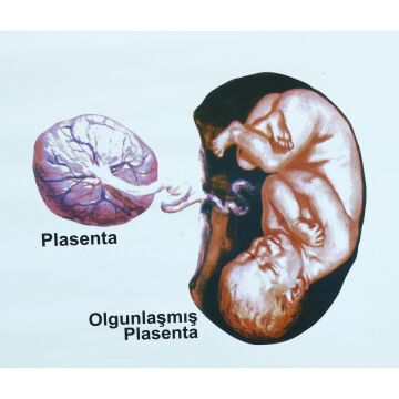 PLESTAL DOLAŞIM LEVHASI