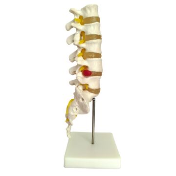 VERTABRA KESİT MODELİ