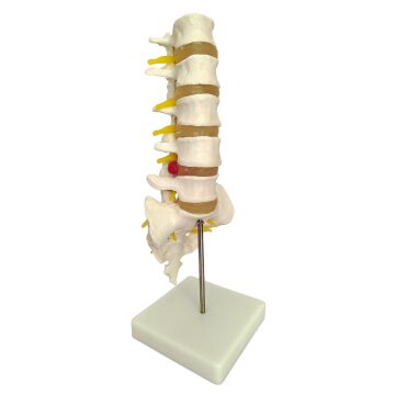 VERTABRA KESİT MODELİ