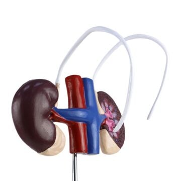 BOŞALTIM SİSTEMİ MODELİ