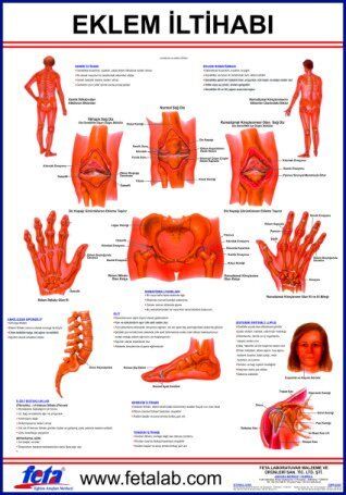 EKLEM İLTİHABI LEVHASI