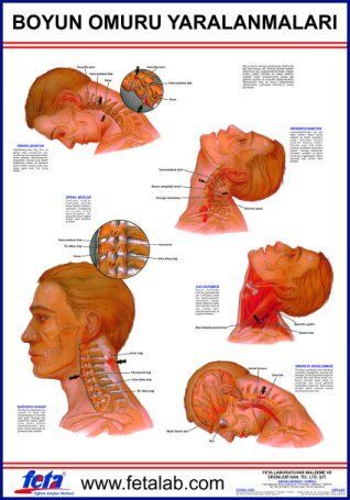 Baş Ve Boyun Yaralanmaları Eğitim Plakası