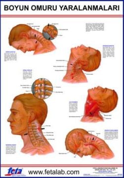 Baş Ve Boyun Yaralanmaları Eğitim Plakası