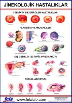 Jinekolojik Hastalıklar Eğitim Plakası