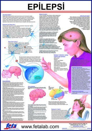 Epilepsi Eğitim Plakası