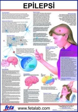 Epilepsi Eğitim Plakası