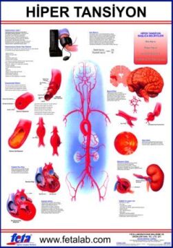 Hipertansiyon Eğitim Plakası