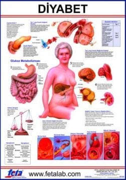 DİYABET LEVHASI