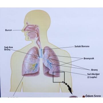 SOLUNUM SİSTEMİ (KAPLI, 70X100)