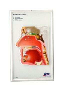 BURUN KESİTİ KABARTMA