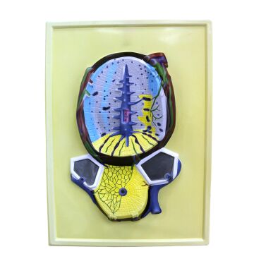 KARACİĞER KESİTİ